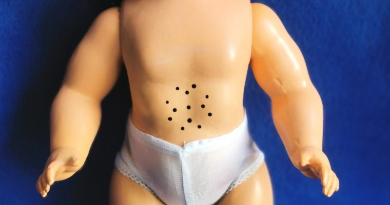 Atelier Arianne-Clinique de poupées- Restauration poupée Gégé de la fin des années 50.