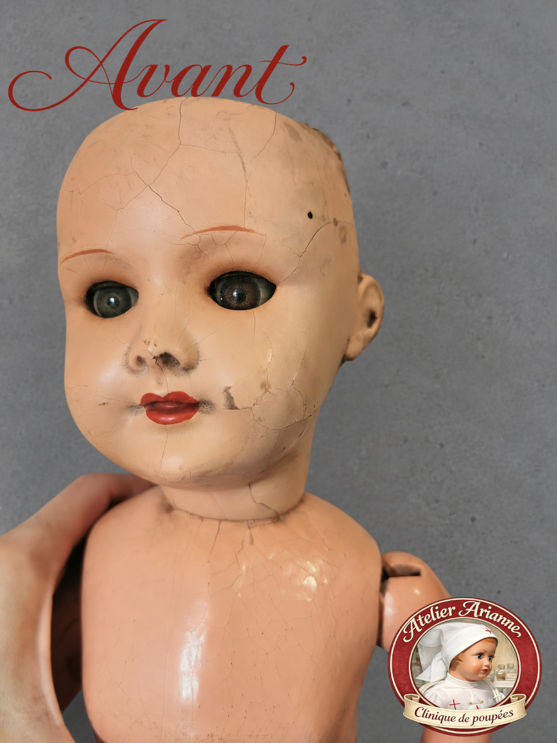 Le visage et le haut du corps avant les soins.