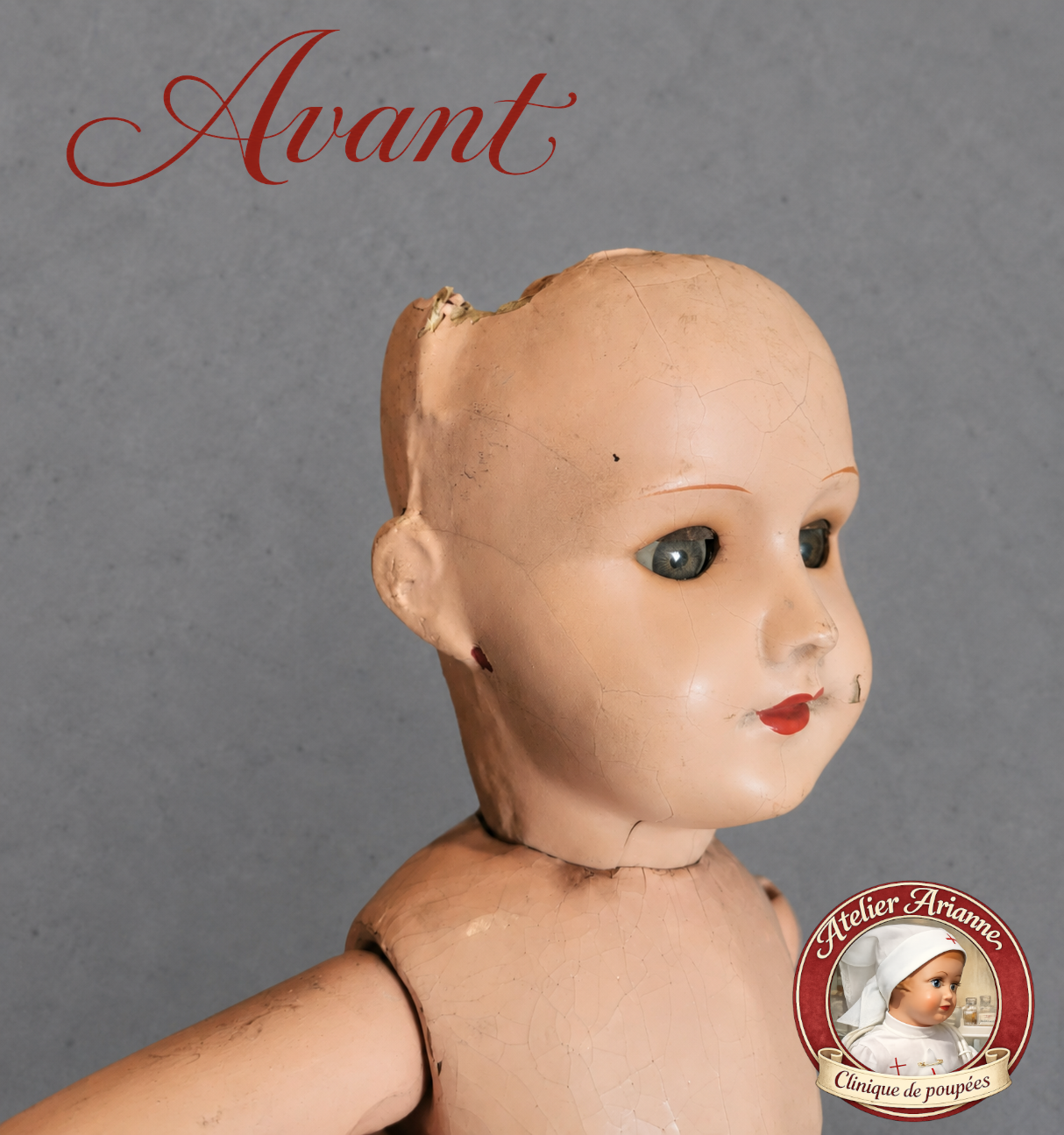 Les fissures étaient visibles jusque sur le côté du visage.